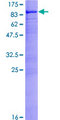 MYLK2 Protein - 12.5% SDS-PAGE of human MYLK2 stained with Coomassie Blue