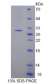 MYLK3 Protein - Recombinant  Myosin Light Chain Kinase 3 By SDS-PAGE