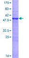 MYO3A Protein - 12.5% SDS-PAGE of human MYO3A stained with Coomassie Blue