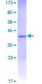 MYO9B Protein - 12.5% SDS-PAGE Stained with Coomassie Blue.