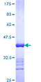 N4BP2 Protein - 12.5% SDS-PAGE Stained with Coomassie Blue.