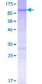 N4BP2L2 Protein - 12.5% SDS-PAGE of human N4BP2L2 stained with Coomassie Blue