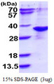 NAA10 / ARD1A Protein