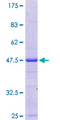 NAA38 / LSMD1 Protein - 12.5% SDS-PAGE of human LSMD1 stained with Coomassie Blue