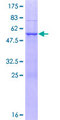 NAA40 Protein - 12.5% SDS-PAGE of human NAT11 stained with Coomassie Blue