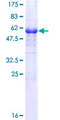 NACA2 Protein - 12.5% SDS-PAGE of human NACA2 stained with Coomassie Blue