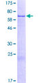 NAIF1 Protein - 12.5% SDS-PAGE of human C9orf90 stained with Coomassie Blue