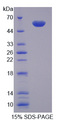 NAMPT / Visfatin Protein - Recombinant Visfatin By SDS-PAGE