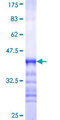 NAP1L4 Protein - 12.5% SDS-PAGE Stained with Coomassie Blue.