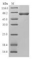 NAPG Protein - (Tris-Glycine gel) Discontinuous SDS-PAGE (reduced) with 5% enrichment gel and 15% separation gel.