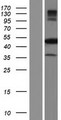 NARF Protein - Western validation with an anti-DDK antibody * L: Control HEK293 lysate R: Over-expression lysate
