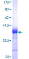 NARF Protein - 12.5% SDS-PAGE Stained with Coomassie Blue.