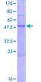 NAT15 Protein - 12.5% SDS-PAGE of human FLJ14154 stained with Coomassie Blue