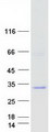 NAT15 Protein - Purified recombinant protein NAA60 was analyzed by SDS-PAGE gel and Coomassie Blue Staining