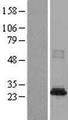 NAT8B Protein - Western validation with an anti-DDK antibody * L: Control HEK293 lysate R: Over-expression lysate