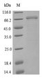 NCAM / CD56 Protein - (Tris-Glycine gel) Discontinuous SDS-PAGE (reduced) with 5% enrichment gel and 15% separation gel.