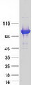 NCKIPSD / AF3P21 Protein - Purified recombinant protein NCKIPSD was analyzed by SDS-PAGE gel and Coomassie Blue Staining