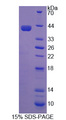 NCOA3 / SRC-3 / AIB1 Protein - Recombinant Nuclear Receptor Coactivator 3 By SDS-PAGE
