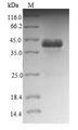 NDUFA12 / B17.2 Protein - (Tris-Glycine gel) Discontinuous SDS-PAGE (reduced) with 5% enrichment gel and 15% separation gel.