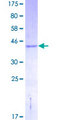 NDUFA13 / GRIM19 Protein - 12.5% SDS-PAGE of human GRIM19 stained with Coomassie Blue