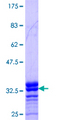 NDUFA8 Protein - 12.5% SDS-PAGE Stained with Coomassie Blue.