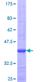 NDUFB4 / B15 Protein - 12.5% SDS-PAGE of human NDUFB4 stained with Coomassie Blue
