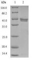 NDUFB5 Protein - (Tris-Glycine gel) Discontinuous SDS-PAGE (reduced) with 5% enrichment gel and 15% separation gel.