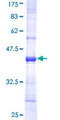 NDUFB5 Protein - 12.5% SDS-PAGE Stained with Coomassie Blue.