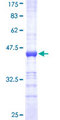NDUFB7 / B18 Protein - 12.5% SDS-PAGE Stained with Coomassie Blue.