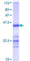 NDUFS6 Protein - 12.5% SDS-PAGE Stained with Coomassie Blue.