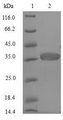 NEFH / NF-H Protein - (Tris-Glycine gel) Discontinuous SDS-PAGE (reduced) with 5% enrichment gel and 15% separation gel.