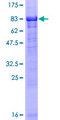 NEK10 Protein - 12.5% SDS-PAGE of human NEK10 stained with Coomassie Blue