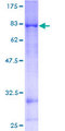 NEK11 Protein - 12.5% SDS-PAGE of human NEK11 stained with Coomassie Blue