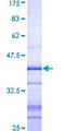 NEK3 Protein - 12.5% SDS-PAGE Stained with Coomassie Blue.