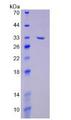 NEP / DDR1 Protein - Recombinant Discoidin Domain Receptor Family, Member 1 By SDS-PAGE