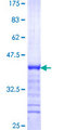 NFXL1 Protein - 12.5% SDS-PAGE Stained with Coomassie Blue.
