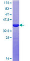 NGEF / EPHEXIN Protein - 12.5% SDS-PAGE Stained with Coomassie Blue.