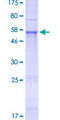 NHLRC3 Protein - 12.5% SDS-PAGE of human NHLRC3 stained with Coomassie Blue