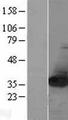 NIT2 Protein - Western validation with an anti-DDK antibody * L: Control HEK293 lysate R: Over-expression lysate