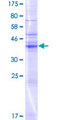 NKAIN2 Protein - 12.5% SDS-PAGE of human NKAIN2 stained with Coomassie Blue