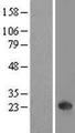 NKIRAS1 Protein - Western validation with an anti-DDK antibody * L: Control HEK293 lysate R: Over-expression lysate