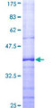 NKIRAS1 Protein - 12.5% SDS-PAGE Stained with Coomassie Blue.