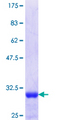 NKX2-8 Protein - 12.5% SDS-PAGE Stained with Coomassie Blue.
