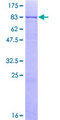 NLK Protein - 12.5% SDS-PAGE of human NLK stained with Coomassie Blue