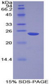 NME6 Protein - Recombinant Non Metastatic Cells 6, Protein Expressed In By SDS-PAGE