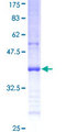 NME7 Protein - 12.5% SDS-PAGE Stained with Coomassie Blue.