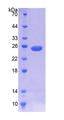 NOMO1 / PM5 Protein - Recombinant  NODAL Modulator 1 By SDS-PAGE