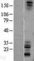 NOTCH1 Protein - Western validation with an anti-DDK antibody * L: Control HEK293 lysate R: Over-expression lysate