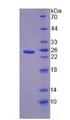 NOVA1 Protein - Recombinant Neuro Oncological Ventral Antigen 1 (NOVA1) by SDS-PAGE