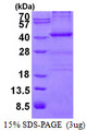 NPM1 / NPM / Nucleophosmin Protein